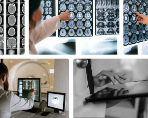 datortomografi
